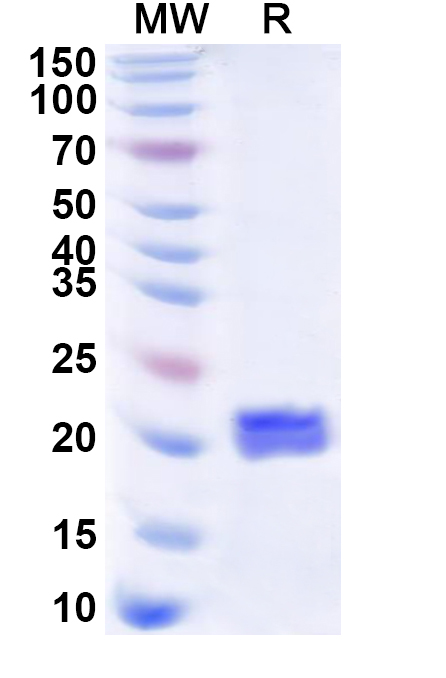 SDS-PAGE for Recombinant Human RPL12 Protein, N-His