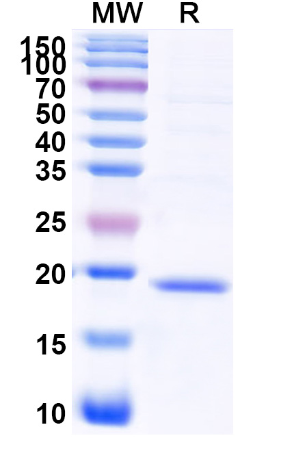 SDS-PAGE for Recombinant Human RPL17 Protein, N-His