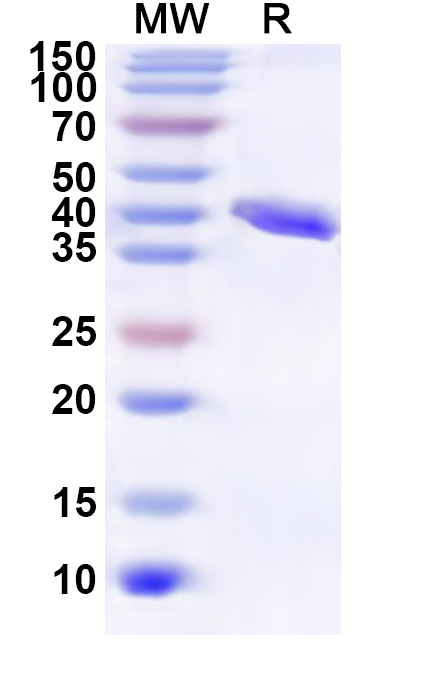 SDS-PAGE for Recombinant Human RPL26 Protein, N-GST & C-His