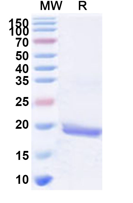 SDS-PAGE for Recombinant Human RPL36A Protein, N-His