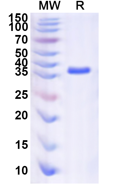 SDS-PAGE for Recombinant Human RPL37A Protein, N-GST & C-His