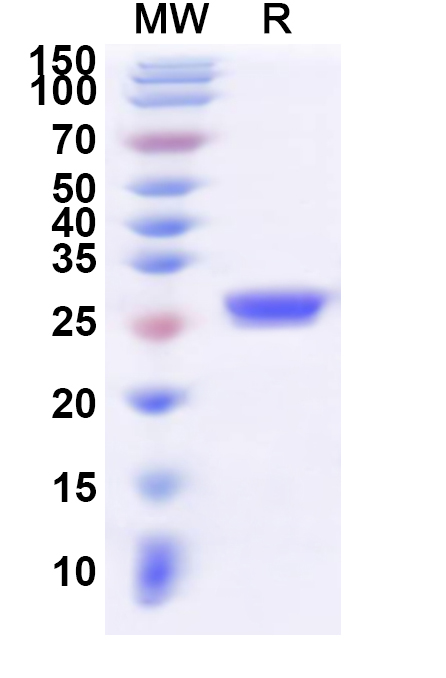 SDS-PAGE for Recombinant Human RPP30 Protein, N-His