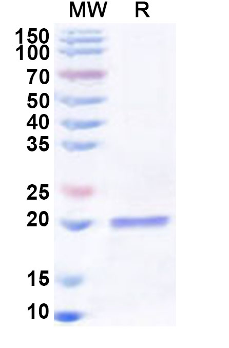 SDS-PAGE for Recombinant Human RPS17 Protein, N-His