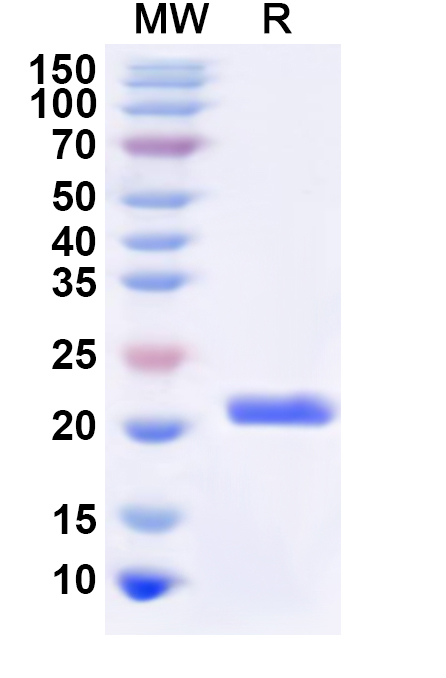 SDS-PAGE for Recombinant Human RPS2 Protein, N-His