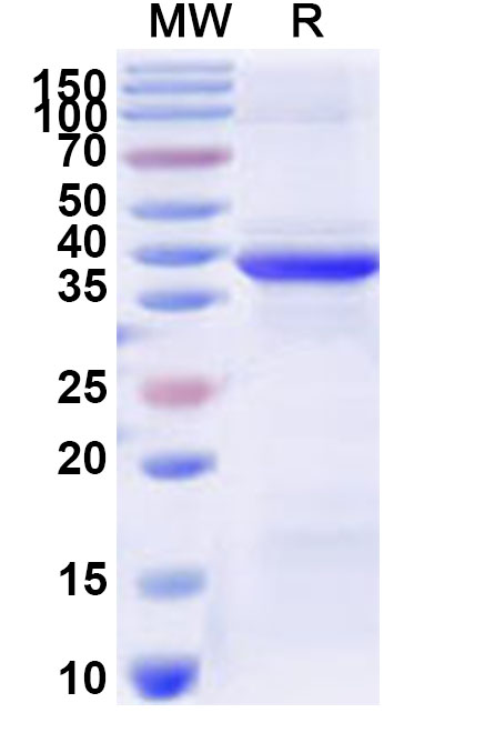 SDS-PAGE for Recombinant Human RPS29 Protein, N-GST & C-His
