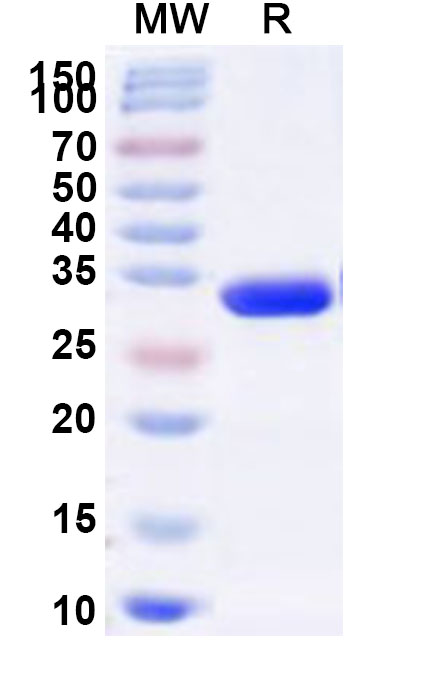 SDS-PAGE for Recombinant Human RPS4X Protein, N-His