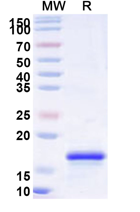 SDS-PAGE for Recombinant Human RPS6 Protein, N-His