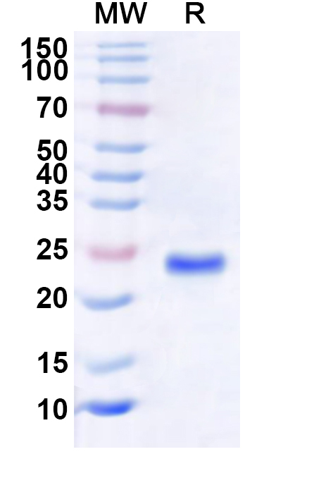 SDS-PAGE for Recombinant Human RTP2 Protein, N-His