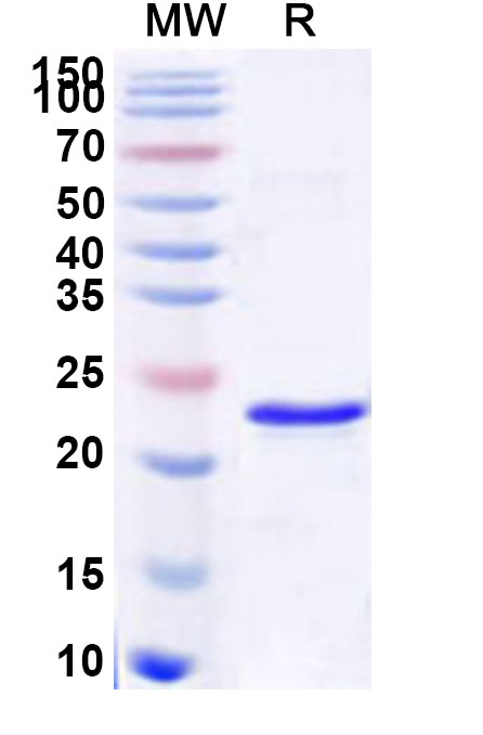 SDS-PAGE for Recombinant Human SAP30 Protein, N-His