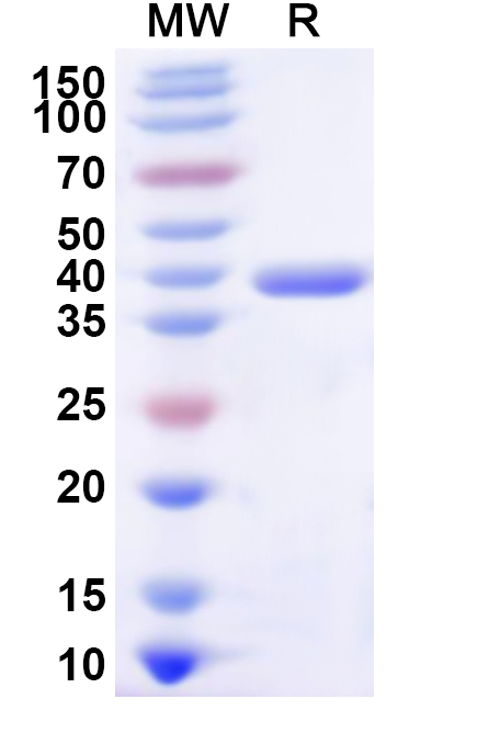 SDS-PAGE for Recombinant Human SARS1 Protein, N-His