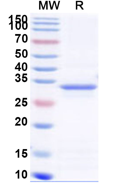 SDS-PAGE for Recombinant Human SBK3 Protein, N-His