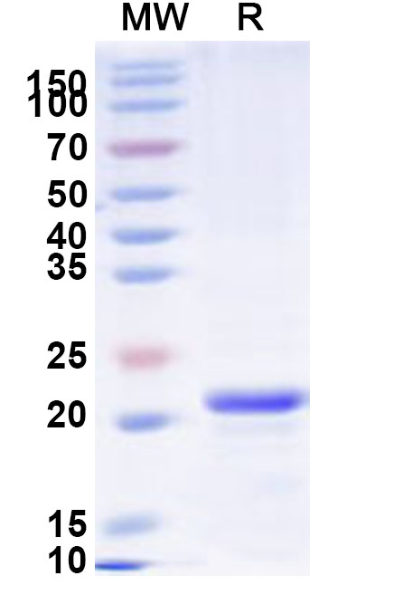 SDS-PAGE for Recombinant Human SCAMP1 Protein, N-His