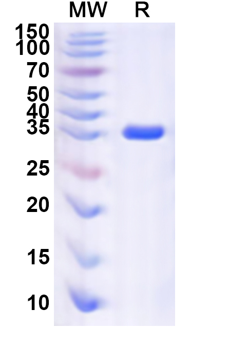 SDS-PAGE for Recombinant Human SCAND1 Protein, N-GST & C-His