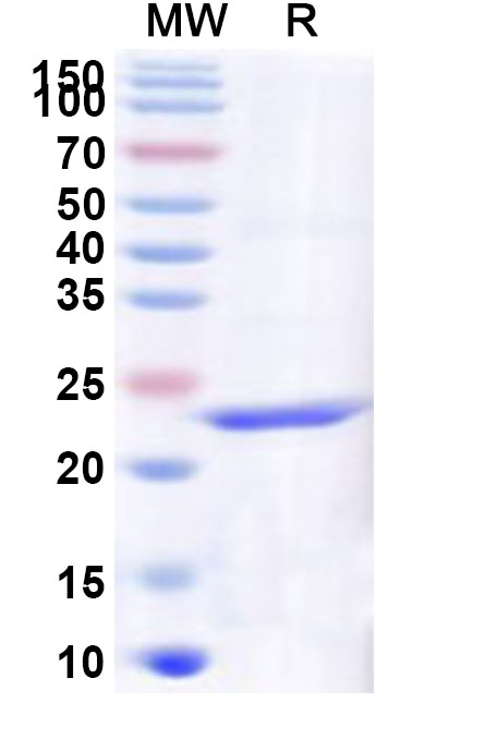 SDS-PAGE for Recombinant Human SCD5 Protein, N-His