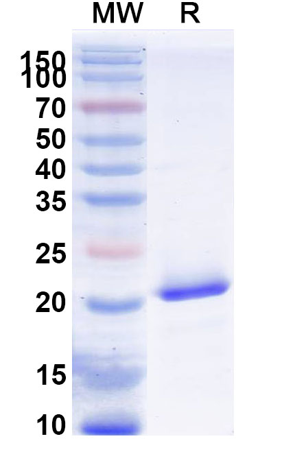 SDS-PAGE for Recombinant Human SCN9A Protein, N-His