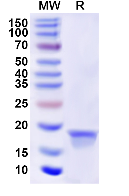 SDS-PAGE for Recombinant Human SCTR Protein, N-His