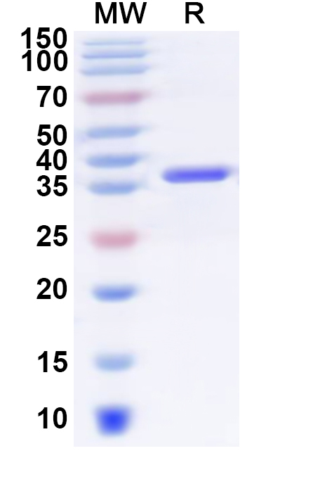 SDS-PAGE for Recombinant Human SDC3 Protein, N-His-KSI