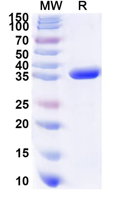 SDS-PAGE for Recombinant Human SDS Protein, N-His