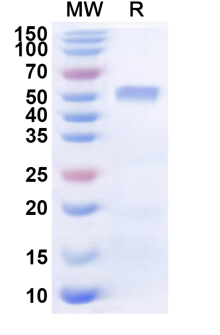 SDS-PAGE for Recombinant Human SEMA3B Protein, N-His