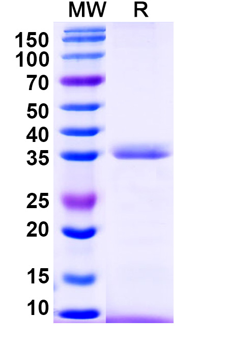 SDS-PAGE for Recombinant Human SERPINA7, N-His
