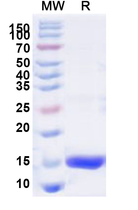 SDS-PAGE for Recombinant Human SF3A1 Protein, N-His