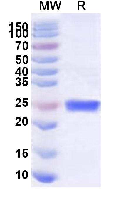 SDS-PAGE for Recombinant Human SF3B4 Protein, N-His
