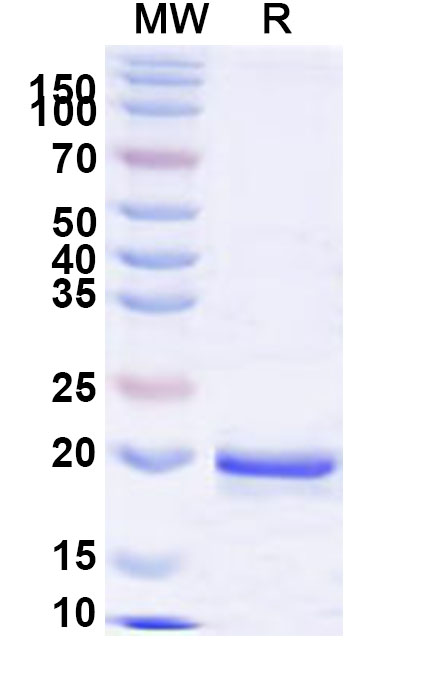 SDS-PAGE for Recombinant Human SFPQ Protein, N-His