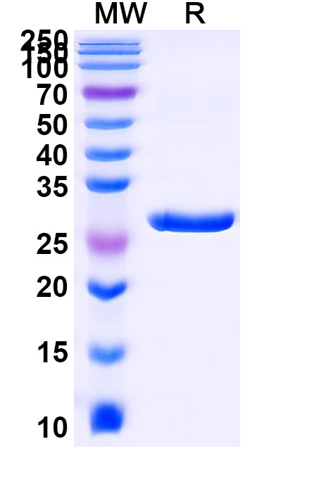 SDS-PAGE for Recombinant Human SFTPA1 Protein, N-His-SUMO