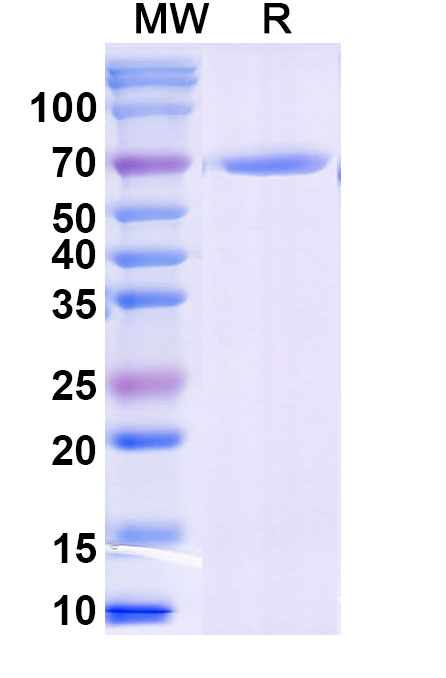 SDS-PAGE for Recombinant Human SHMT2, N-His