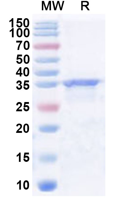 SDS-PAGE for Recombinant Human SHPRH Protein, N-His
