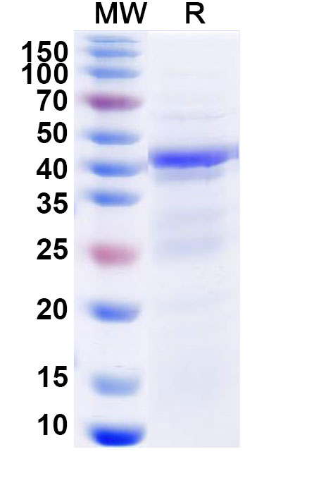 SDS-PAGE for Recombinant Human SIRT6, N-His
