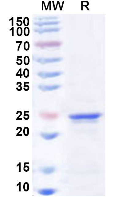 SDS-PAGE for Recombinant Human SIX6 Protein, N-His