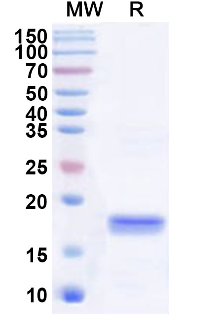 SDS-PAGE for Recombinant Human SLA Protein, N-His