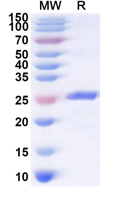 SDS-PAGE for Recombinant Human SLAMF6 Protein, N-His