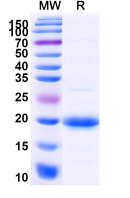 SDS-PAGE for Recombinant Human SLC10A1 Protein, N-His-SUMO