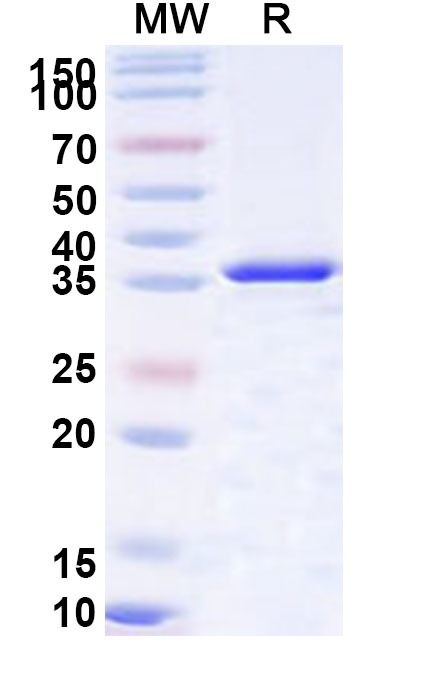 SDS-PAGE for Recombinant Human SLC12A5/KCC2 Protein, N-His