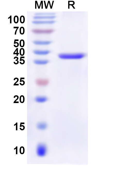 SDS-PAGE for Recombinant Human SLC12A8 Protein, N-His-KSI