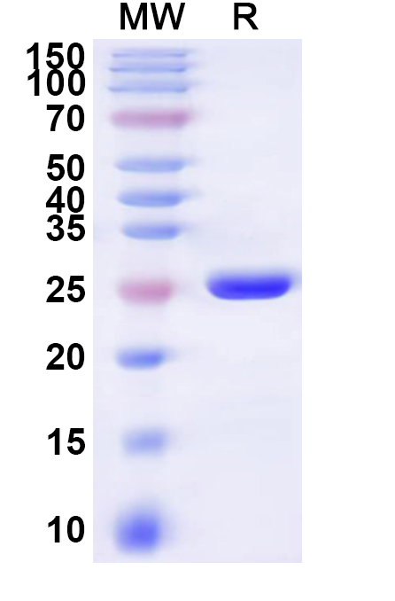 SDS-PAGE for Recombinant Human SLC13A3 Protein, N-His-KSI