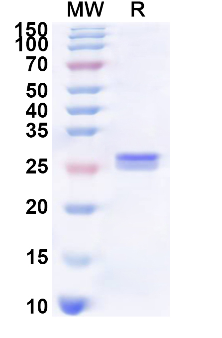 SDS-PAGE for Recombinant Human SLC15A2 Protein, N-His