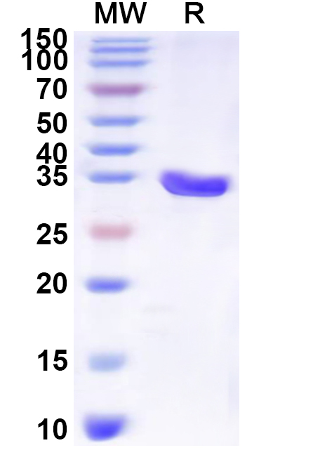 SDS-PAGE for Recombinant Human SLC16A4 Protein, N-His-KSI