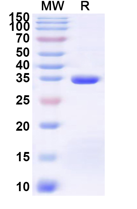 SDS-PAGE for Recombinant Human SLC19A2 Protein, N-His-KSI