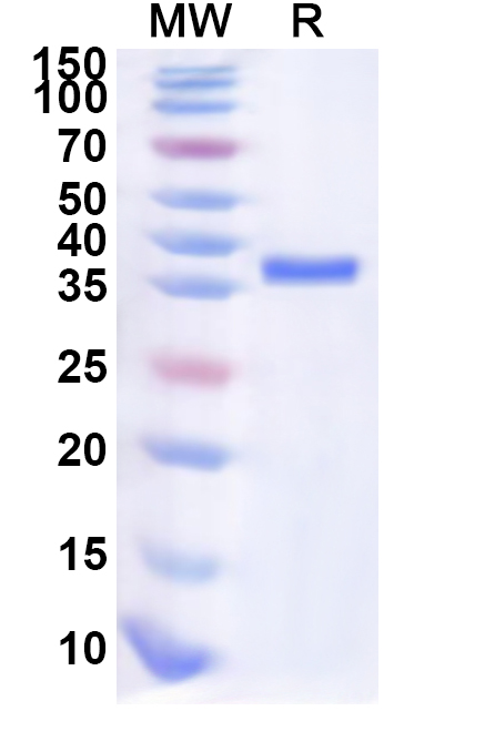 SDS-PAGE for Recombinant Human SLC19A3 Protein, N-GST & C-His