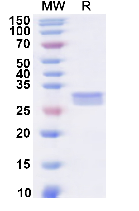 SDS-PAGE for Recombinant Human SLC1A4 Protein, N-His-KSI