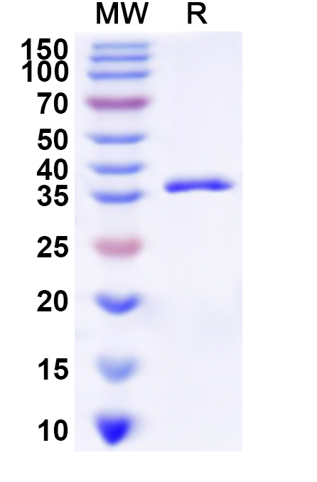 SDS-PAGE for Recombinant Human SLC1A6 Protein, N-GST & C-His