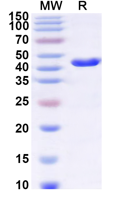 SDS-PAGE for Recombinant Human SLC25A1 Protein, N-GST & C-His