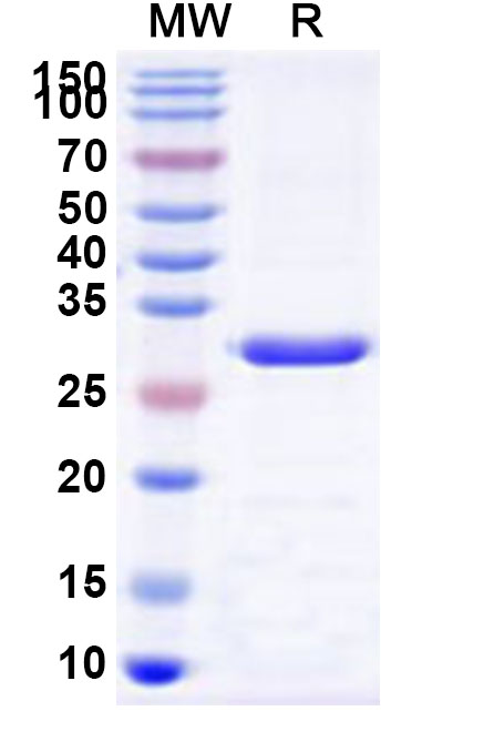 SDS-PAGE for Recombinant Human SLC26A4 Protein, N-His