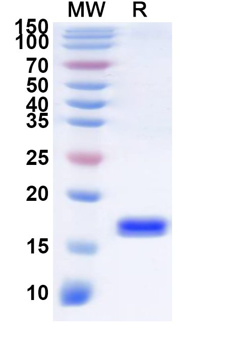 SDS-PAGE for Recombinant Human SLC29A1 Protein, N-His