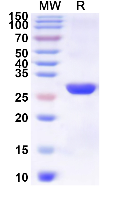 SDS-PAGE for Recombinant Human SLC2A2 Protein, N-His-KSI