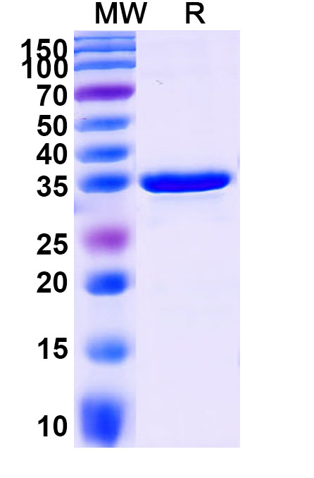 SDS-PAGE for Recombinant Human SLC2A9 Protein, N-GST & C-His
