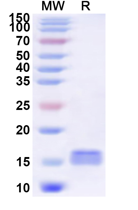 SDS-PAGE for Recombinant Human SLC30A10 Protein, N-His